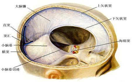 脑疝的护理措施 脑疝的预防措施 如何预防脑疝的发生