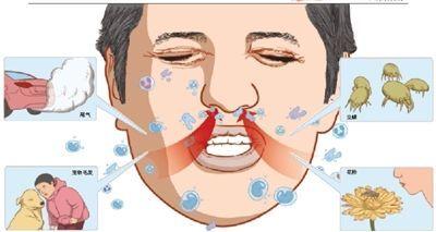 治过敏性鼻炎的药排名 过敏性鼻炎怎么治疗？