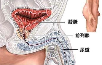 如何按摩前列腺图解 如何按摩前列腺？