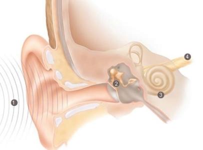 戴游泳耳塞后听力下降 长期用耳塞听歌会导致听力下降吗？