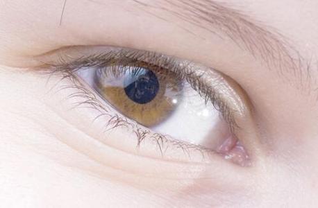 结膜炎用什么眼药水 结膜炎怎么治疗