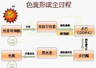 色斑的形成 形成色斑的内外因素