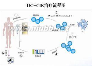 dc cik细胞免疫治疗 DC-CIK细胞免疫治疗技术 DC-CIK细胞免疫治疗技术-DC-CIK细胞免疫