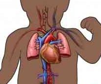 小儿肺动脉高压 小儿肺动脉高压-疾病概述，小儿肺动脉高压-发病