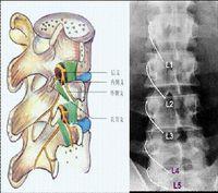 颈椎间盘突出症 颈椎间盘突出症-基本概述，颈椎间盘突出症-发病