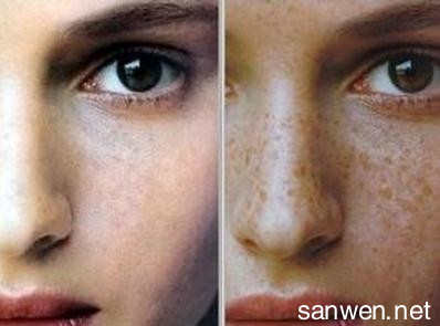 脸上长斑是什么原因 脸上长斑的原因 脸上长斑怎么办
