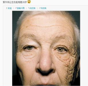 光老化 光老化-概述，光老化-与自然老化区别