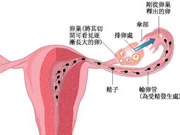 输卵管介入手术 输卵管介入复通术 输卵管介入复通术-介绍，输卵管介入复通术-用