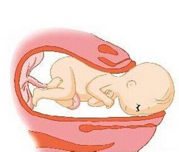前壁胎盘是男孩的原因 胎盘位于子宫前壁是男孩还是女孩