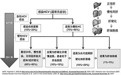 慢性肝炎发病率 慢性肝炎 慢性肝炎-疾病介绍，慢性肝炎-发病原因及分类