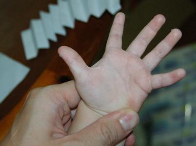 手脱皮 手脱皮-病理病因，手脱皮-诊断