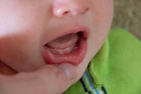 宝宝长牙口腔怎么处理 如何处理宝宝长牙