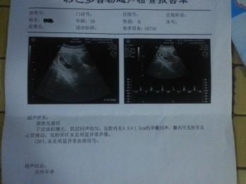 孕三个月还容易胎停吗 怀孕三个月胎停症状
