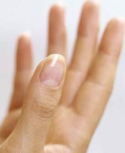 手指甲上有竖纹 我们为何有手指甲？
