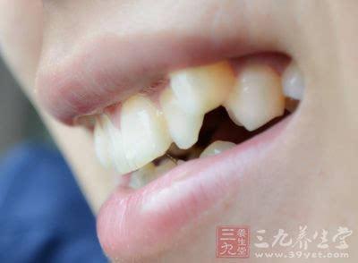 芽出血什么原因 牙齿出血的原因是什么？