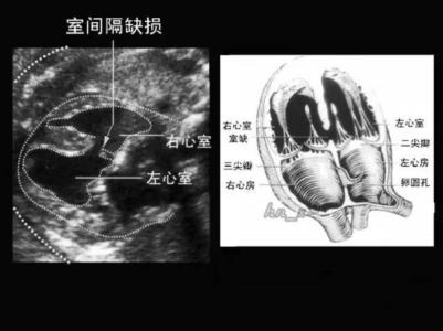 畸形胎儿 畸形胎儿-简介，畸形胎儿-形成