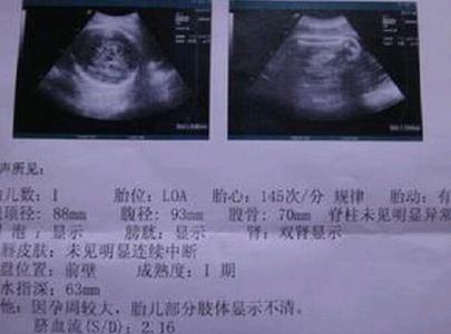 b超单看胎儿性别图 b超单怎么看,b超数据看胎儿性别