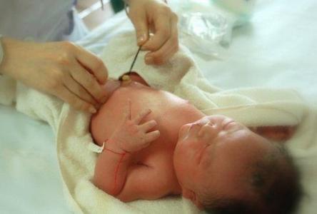 新生儿脐部如何护理 新生儿脐部如何的护理?