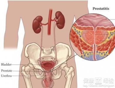 前列腺囊肿 前列腺囊肿-简介，前列腺囊肿-概述
