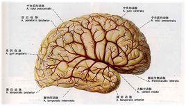 脑动脉硬化 脑动脉硬化-疾病概述，脑动脉硬化-原因