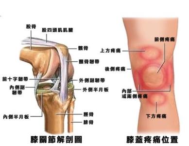 女膝盖痛是什么原因 膝盖痛是什么原因