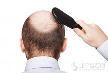 防脱发 防脱发-男性脱发的原因，防脱发-女性脱发的原因