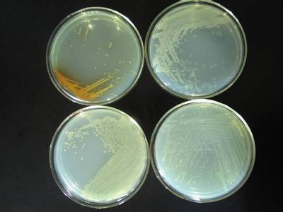 氨基酸自养微生物 氨基酸发酵微生物 氨基酸发酵微生物-基本信息，氨基酸发酵微生物