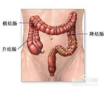 结肠癌早期症状 结肠炎最佳治疗方法