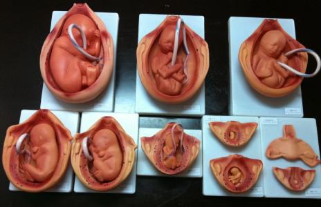 妊娠线看胎儿性别 胎儿[妊娠后未出生的儿体] 胎儿[妊娠后未出生的儿体]-胎儿发育，