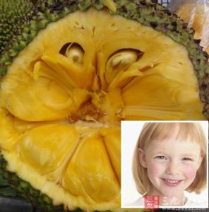 吃菠萝过敏的症状图片 菠萝蜜过敏症状