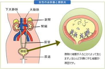 子宫肌瘤影响受孕吗 手机放在哪里会影响受孕