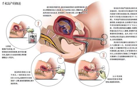 脾破裂术后并发症 子宫破裂并发症简介