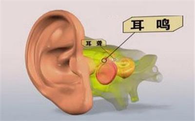 哪些疾病可以引起耳鸣 耳鸣反映什么疾病