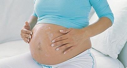 预防妊娠纹宋丽秋信赖 哪些孕妈妈容易长妊娠纹怎样预防