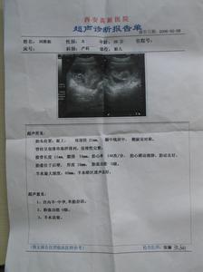 那件事让我了解了他 做B超前需要了解3件事