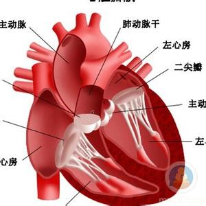 10大另类动画片 心脏病10大“另类”症状