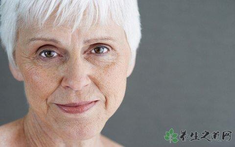 如何防止老年斑产生 如何防止老年斑