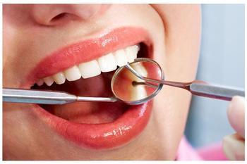 洗牙后牙齿松动 洗牙后要如何护理牙齿