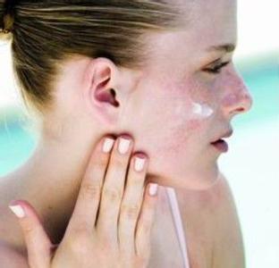 冬季皮肤病 冬季护肤怎样预防三大皮肤病