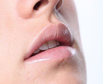 冬季嘴唇干裂 如何解决冬季唇部干裂问题