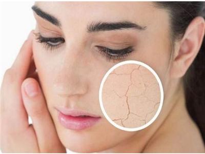 干性缺油皮肤怎么改善 干性皮肤有什么特点