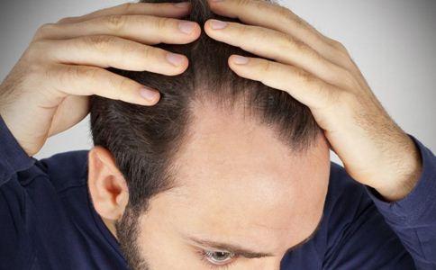 如何预防脱发 男人要如何预防脱发