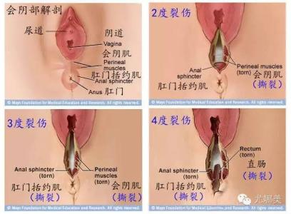 剖腹产后恶露颜色 剖腹产后恶露颜色怎么样