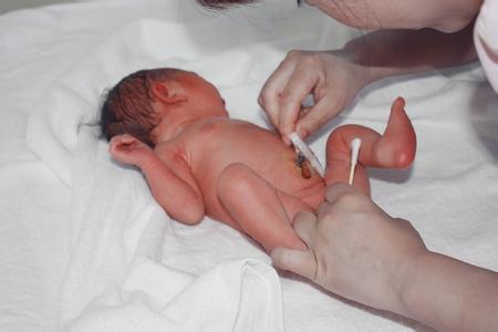 新生儿眼底筛查必要性 给新生儿洗澡的必要性有哪些