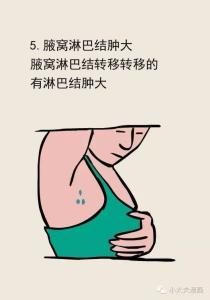 这事儿芸知道 关于乳腺癌，你必须要知道的事儿