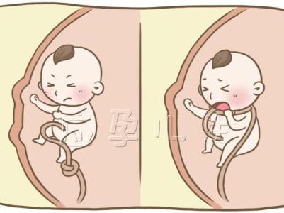 身体状况分为哪几种 胎动分为哪几种状况