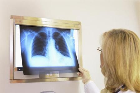 排出肺部毒素 怎样简单排出肺部毒素