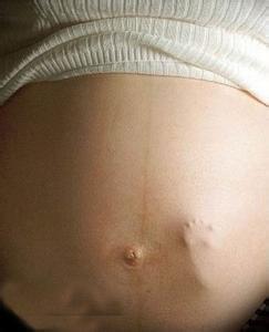 怀孕5个月胎动位置低 胎动位置很低正常吗
