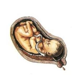 胎盘位于子宫前壁 胎盘位于子宫前壁有什么症状