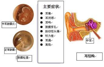 中耳炎的危害 中耳炎造成的危害有哪些